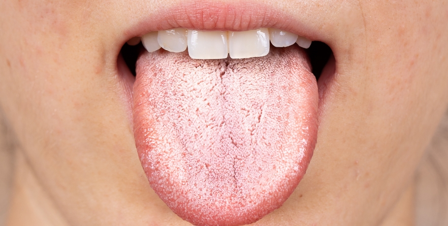 What are the symptoms of Candida overgrowth or other fungus?